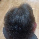 현암로89번길 | 용인탈모관리 두피관리 가르마 머리숱 자신감 채워주는 닷포유