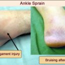 솔한방병원 이미지
