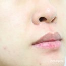 마이스킨케어