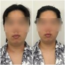 배곧 에스테틱 럽인바디핏 두피리프팅 스칼프핏