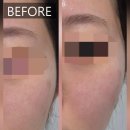 다예랩 | [내돈내산 후기😶‍🌫️]Dr.Tengle 닥터탱글 고주파 마사지 디바이스