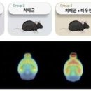 알츠하이머 초기 : 치매 종류별 원인과 알아보자 이미지