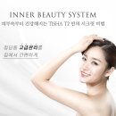 티투피