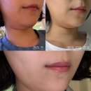 닥터손유나의원 1회차 : 이중턱 부자들 다 모여라...