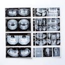 프라임덴탈 | 내 치아 쫌쫌따리 챙겨야 할 때가 왔더라구용