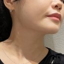 청담안즈피부과의원 | [강남구청역 피부과, 티타늄리프팅] 청담안즈피부과의원