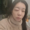 윤안과의원 | 이천 연세윤 안과의원에서 다래끼 치료하기