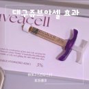 온더아셀