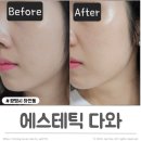 하안사거리 하나은행 앞 | 하안동 피부샵 에스테틱 다와 맞춤형 피부관리 브리티리프팅 하안사거리 피부샵 추천