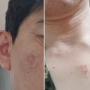 김원섭내과의원 | 코로나19 백신(아스트라제네카) 접종 후기