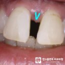 찬스플란트치과의원 이미지