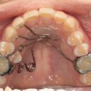 엘치과기공소 이미지