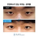 안병준성형외과의원 | 여성들은 아름다움을, 남성들은 사회 경쟁력을 높이기 위해...