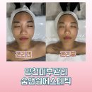 목동시원한의원 | 목동피부관리/신정동피부관리- 숨앤쉼에스테틱, 작은얼굴 대만족 후기