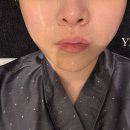 6623 | 천안피부관리 불당동 [ 와이젯 에스테틱 ] 속건조 케어 후기 촉촉촉촉 💦