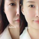 홈케어 리프팅 뷰티디바이스 추천, 티타몬드 퀸 중주파 마사지기 솔직후기