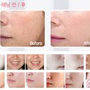 다미인피부비만관리 이미지