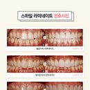 아름드리기공소 이미지