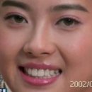 스테이온기 이미지