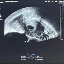 이즈맘산부인과의원 | 임신 8주 산부인과 변경 이즈맘산부인과 전원 주차
