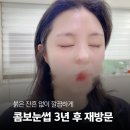 크레벨라뷰티 | 성내동눈썹문신 | 3년 뒤 붉은 잔흔 없는 이유, 재시술 후기로 증명합니다