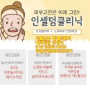 인셀덤블링블링뷰티