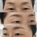 브로우바이현