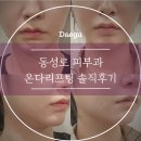달.콤커피대구 | 대구 동성로 피부과 이중턱, 심부볼 타파! 30대 직장인 온다리프팅 50만줄 솔직후기