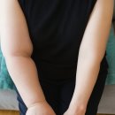 홍보가 기가막혀 | 5년간 800만원 쓰고 깨달은 림프부종 해결법(※실후기+3줄요약 O)