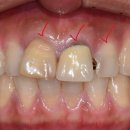 아트리움치과기공소 이미지