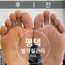 주식회사 유케어원 | 평택네일 평택역네일샵 유네일 부모님 발 각질케어 후기