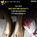 작은따옴표