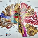 뇌가 힘들 땐 미술관에 가는 게 좋다 이미지