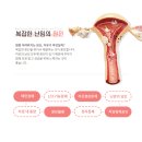 바로유한의원 이미지