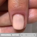 삼성중앙역 네일샵, 손톱 피부과 대신 네일 케어 후기