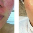 필바이오 이미지