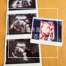 11260-1-21-6 | 21주 정밀초음파 24주 임신성 당뇨검사 임당검사 검사항목 금식 비용 청주엠에스여성의원