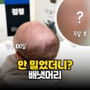 머리와가위 | 배냇머리 안밀고 미용가위로만 손봤는데.. 머리숱 변화 후기