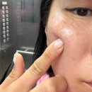이젠바이오 | 울산 30대여자 피부관리 바이오리필 후기 중구 위크원