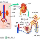 혈액투석 안내 이미지