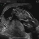 고덕민산부인과의원 이미지