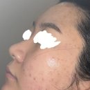 세븐일레븐 의정부센트럴타워점 | 의정부 얼굴 경락 전문 강에스테틱 의정부역 에스테틱 피부관리 리얼후기