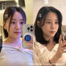 누의원 | [누의원] 써마지,울쎄라, 스킨보톡스 2개월 후기｜기적까진 아니지만 분명한 변화