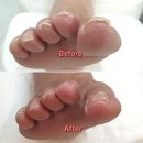 동래구 장애인협회 | 부산내성발톱교정 독일식 발관리 전문점 레푸스 동래사직점