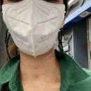 평송의원 | 쥐젓, 편평사마귀, 점 조지기