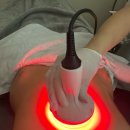 서울피부비만센터 스킨앤슬림 | 강남지방흡입후관리 내돈내산고주파관리 강남단기다이어트 비키슬림앤바디