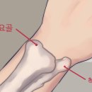 요골 이미지