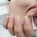 케어: 화양연화 이미지