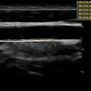 (주)유티비 이미지