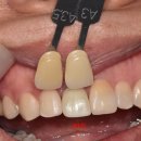 푸른치과기공소 이미지